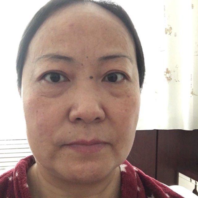 张丽萍