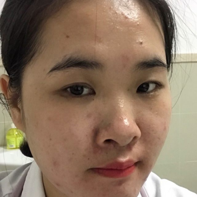 肖静